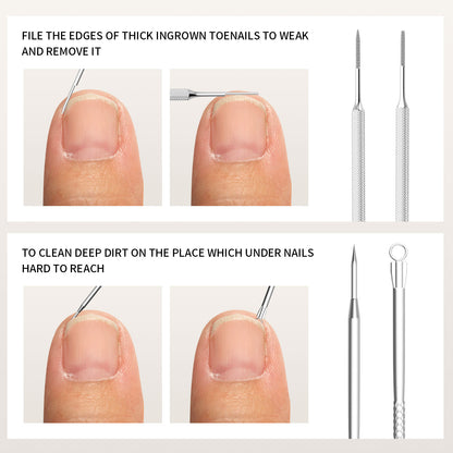 7 Pcs Ingrown Toenail File and Lifters Set, Stainless Steel Ingrown Toenail Removal Kit, Under Nail Cleaner Pedicure Tools