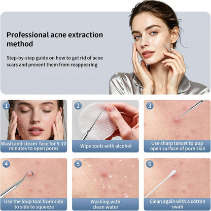 Titanium Lancet Needle Acne Blackhead Remover Pimple Extractor Popper Tool